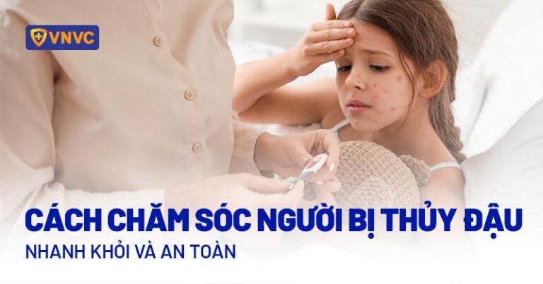 Chăm Sóc Da Sau Khi Bị Thủy đậu