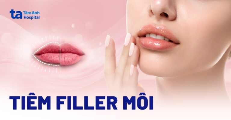 Dáng Môi Tiêm Filler đẹp