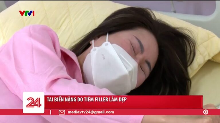 Giá Tiêm Filler - Những Bí Mật Mà Bạn Chưa Biết