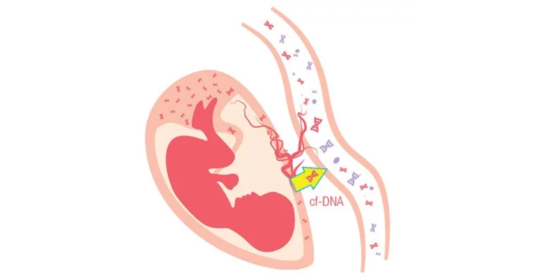 Xét Nghiệm Nipt Là Gì